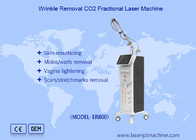 Máquina de laser de CO2 vertical de remoção de pigmento de remoção de cicatrizes