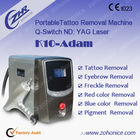 Q- Comute a máquina da remoção da tatuagem do laser do yag do Nd para a sarda Remove