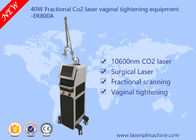 equipamento fracionário do laser do CO2 40w/equipamento de aperto Vaginal comercial