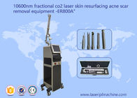 10600nm refrigeram a máquina fracionária do laser do CO2 do feixe para a remoção de Mark de estiramento da cicatriz da acne