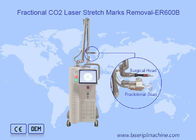 Máquina fracionária do laser do CO2 da exploração 10600nm 10x10mm da remoção da cicatriz