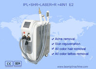 Máquina do laser IPL do ND YAG 530nm da remoção da acne