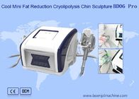 máquina fresca de 12V Mini Fat Reduction Cryolipolysis Slimming