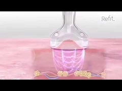 Do vácuo portátil da cavitação MLS05 as celulites ultrassônicas do RF 40K reduzem o dispositivo