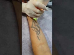A mala de viagem K11 portátil Q-comutou a máquina da remoção da tatuagem do laser de Yag