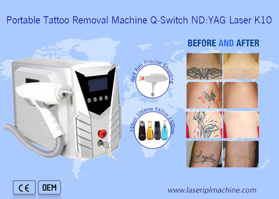 1064nm 532nm Máquina de remoção de tatuagens a laser portátil com alça desmontável