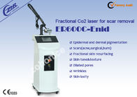 Repita o equipamento fracionário da beleza do tratamento da cicatriz do laser do CO2 do pulso
