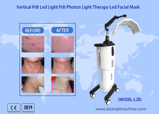 A mais recente máquina fotodinâmica de rejuvenescimento da pele com Bio Light Therapy 650nm.