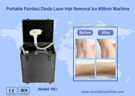 máquina ajustável do laser do diodo do pulso 808nm para a remoção do cabelo