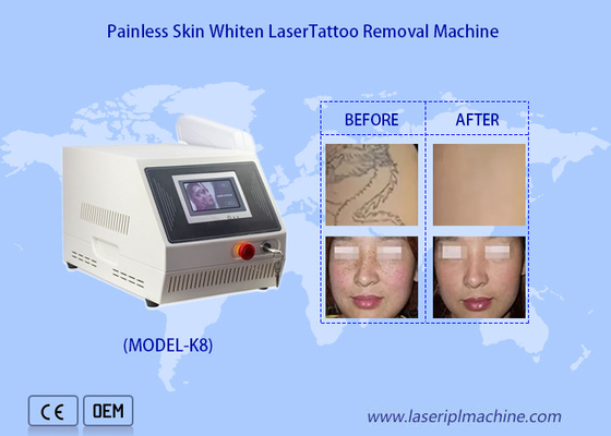 1320nm 1064nm 532nm Máquina portátil Nd Yag Laser de remoção de tatuagens para clareamento da pele