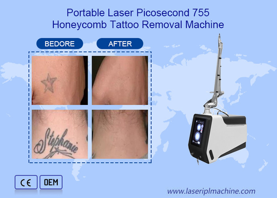 Dispositivo 755nm 1064nm 532nm da máquina da remoção da tatuagem do laser do picosegundo do Nd Yag