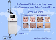 755nm máquina da remoção da tatuagem do laser do picosegundo do Nd Yag