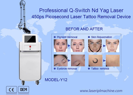 Máquina de remoção de tatuagens a laser de 755nm Nd Yag