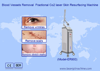 RF Laser de CO2 fracionado para estrias Remover cicatrizes Máquina de aperto vaginal
