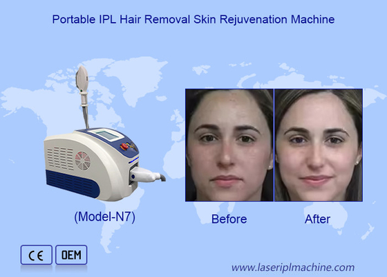 Extirpação avançada de pelos a laser IPL e rejuvenescimento da pele com cristal de luz de safira importado