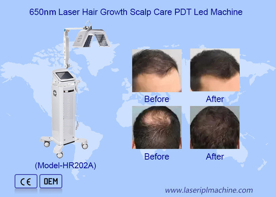 Máquina de estimulação de crescimento do cabelo de alta frequência segura Máquina de terapia a laser