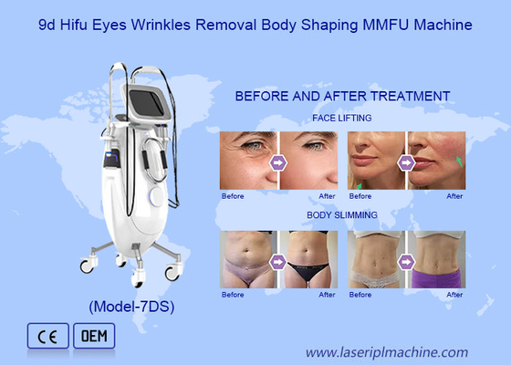 Máquina de emagrecimento não cirúrgico 9D HIFU de remoção de gordura Rejuvenescimento da pele