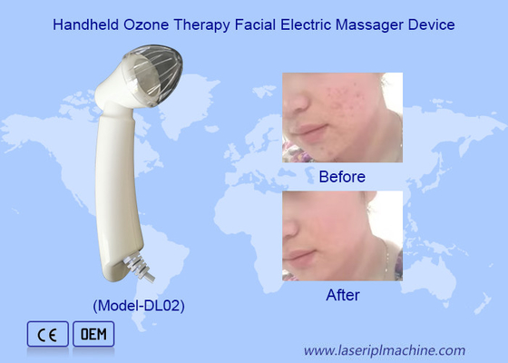 Dispositivo de massagem elétrica facial portátil de terapia de ozônio para remoção de acne de rugas