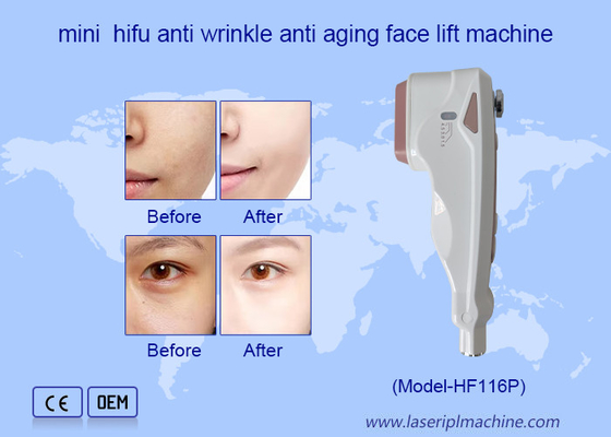 Uso em casa HIFU Cuidados faciais de remoção de rugas Rejuvenescimento da pele Máquina de lifting facial