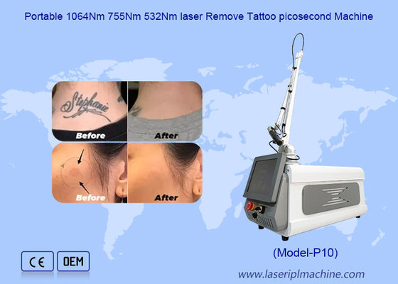Máquina laser Nd Yag de remoção de tatuagens de picossegundos