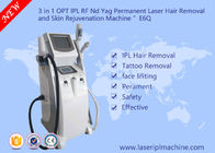 Remoção da tatuagem do laser do equipamento da beleza do equipamento da beleza do rejuvenescimento da pele da clínica/Ipl