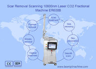 máquina fracionária do laser do CO2 10600nm para Resurfacing da pele