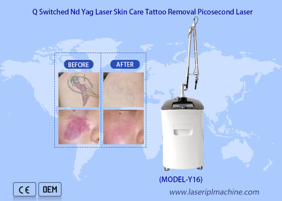 Bom preço Remoção vertical da tatuagem do rejuvenescimento da pele da máquina do laser do picosegundo do Nd Yag on-line