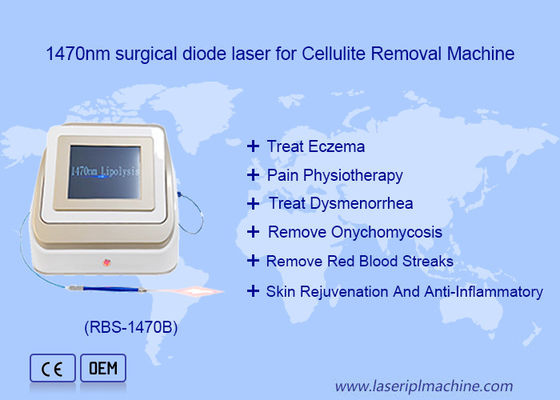Bom preço 1470nm 980nm Diodo Laser Lipólise Cirurgia Dispositivo a Laser Solúvel em Gordura on-line