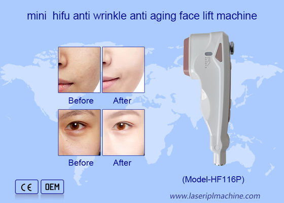 Bom preço Uso em casa HIFU Cuidados faciais de remoção de rugas Rejuvenescimento da pele Máquina de lifting facial on-line