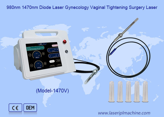 980nm 1470nm Diodo Laser Ginecologia Cirurgia de Aperto Vaginal Laser